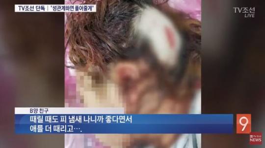 풀어줄게